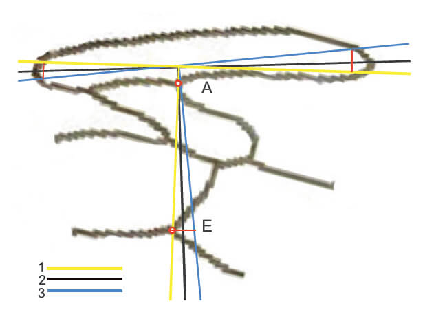 общая погрешность измерения дискоидального смещения