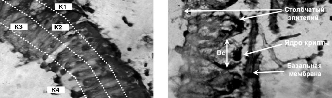 На рисунках эпителий средней кишки пчелы