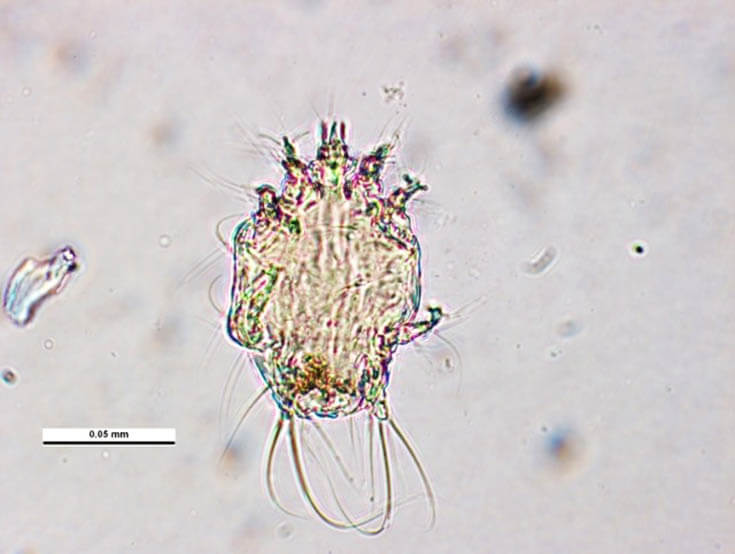 Акарапидоз пчёл под микроскопом