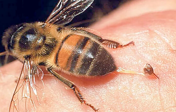 Укус пчелы