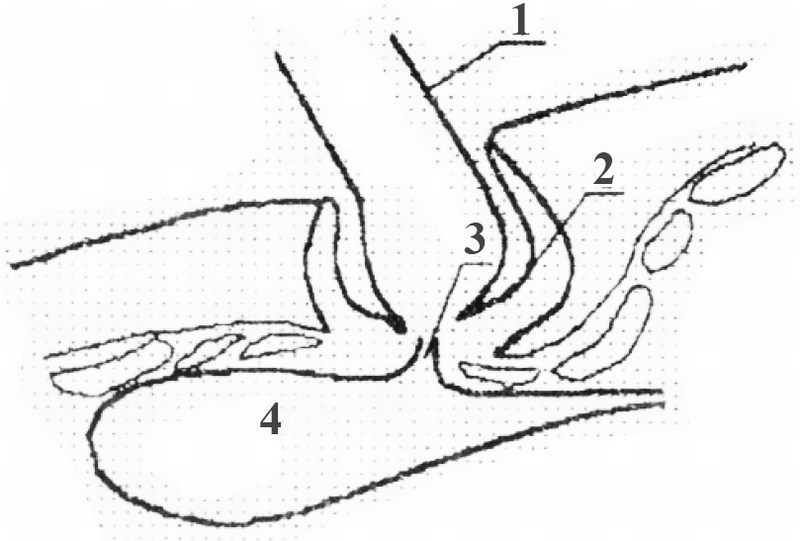 Микроструктура трихоидной медоносной пчелы