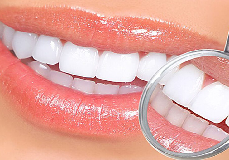 Ротовая полость