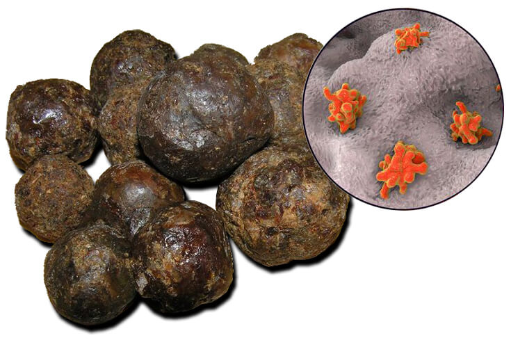 Лечение прополисом