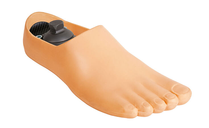 Протезирование