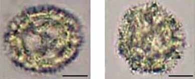 Одуванчик пыльцевые зерна