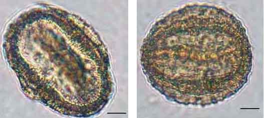 Мордовник широколистный пыльцевые зерна